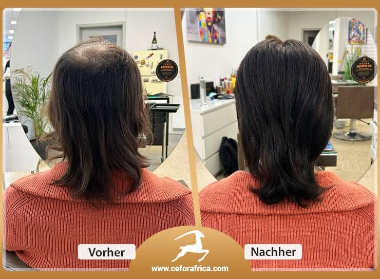 Vorher / Nachher Galerie