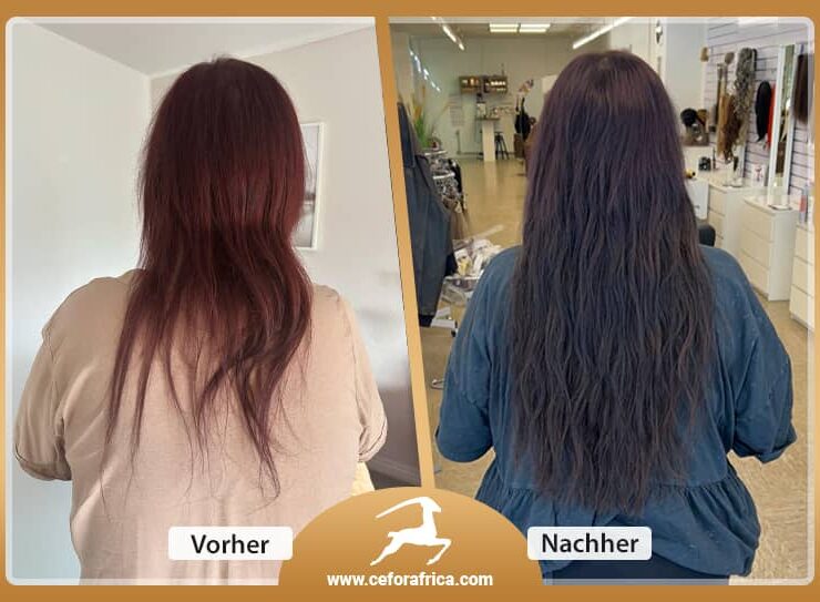 Vorher / Nachher Galerie