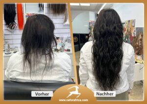 Vorher / Nachher Galerie