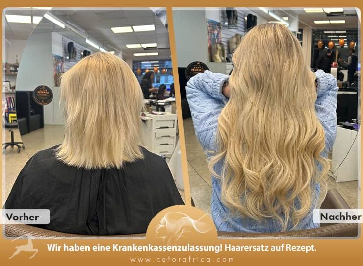 Vorher / Nachher Galerie