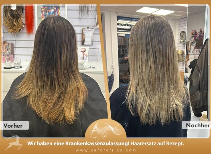 Vorher / Nachher Galerie