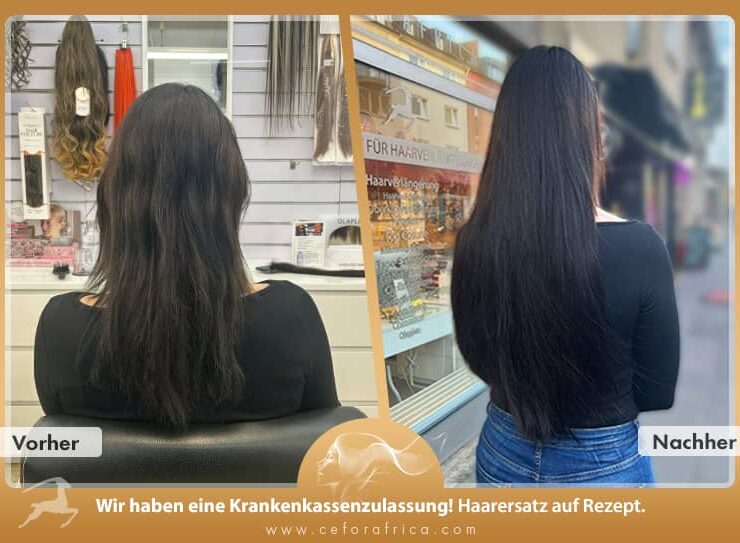 Vorher / Nachher Galerie