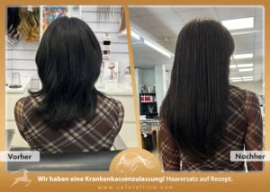 Vorher / Nachher Galerie