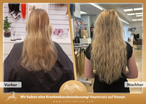 Vorher / Nachher Galerie