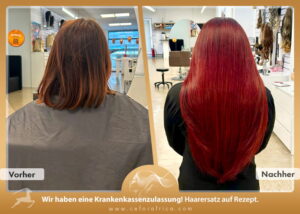 Vorher / Nachher Galerie