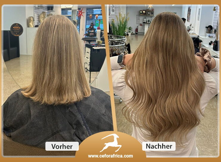 Vorher / Nachher Galerie