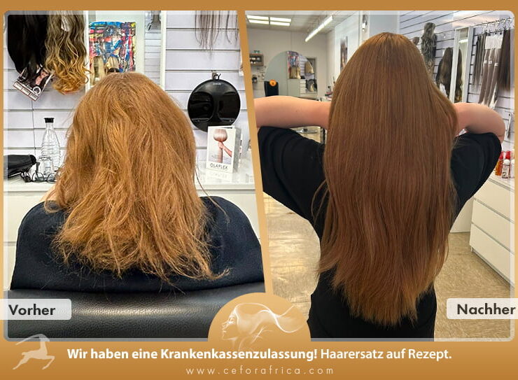 Vorher / Nachher Galerie